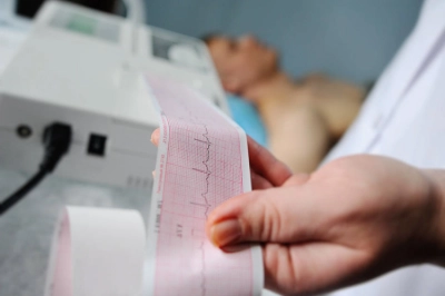 Elettrocardiogramma Dinamico secondo Holter